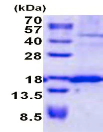 SDS-PAGE - Recombinant Human SSR4 protein (denatured) (AB137145)