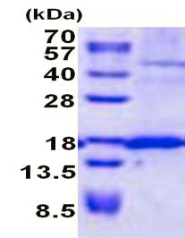 SDS-PAGE - Recombinant Human SSR4 protein (denatured) (His tag N-Terminus) (AB137145)