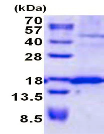 SDS-PAGE - Recombinant Human SSR4 protein (denatured) (His tag N-Terminus) (AB137145)