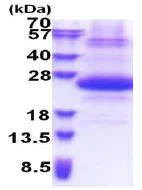 SDS-PAGE - Recombinant Human SSSCA1 protein (denatured) (AB174559)