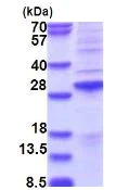SDS-PAGE - Recombinant Human SSX2 protein (denatured) (His tag N-Terminus) (AB181904)