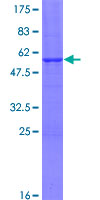 Recombinant Human SSX3 protein