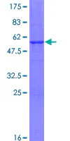 SDS-PAGE - Recombinant Human SSX3 protein (GST tag N-Terminus) (AB160884)