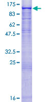 SDS-PAGE - Recombinant Human ST14 protein (AB114597), expandable thumbnail