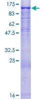 SDS-PAGE - Recombinant Human ST14 protein (GST tag N-Terminus) (AB114597)