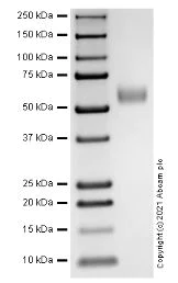 SDS-PAGE - Recombinant Human ST2 protein (Active) (AB283466)