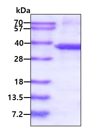SDS-PAGE - Recombinant Human ST3GAL5 protein (denatured) (His tag N-Terminus) (AB176053)