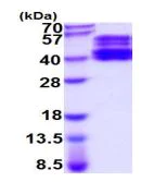 SDS-PAGE - Recombinant Human ST6GAL1 protein (His tag) (AB219247)