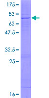 SDS-PAGE - Recombinant Human ST6GALNAC2 protein (AB161069), expandable thumbnail