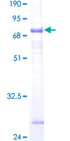 SDS-PAGE - Recombinant Human ST6GALNAC6 protein (AB162319), expandable thumbnail