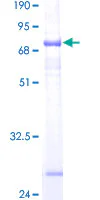 SDS-PAGE - Recombinant Human ST6GALNAC6 protein (GST tag N-Terminus) (AB162319)