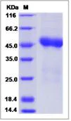 SDS-PAGE - Recombinant Human ST8SIA1 protein (His tag) (AB276673)