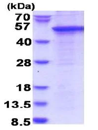 SDS-PAGE - Recombinant Human STAC protein (denatured) (AB180301)