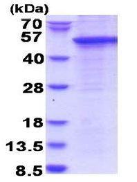 SDS-PAGE - Recombinant Human STAC protein (denatured) (His tag N-Terminus) (AB180301)