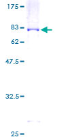 SDS-PAGE - Recombinant Human STAM1 protein (AB159929)