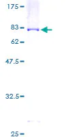 SDS-PAGE - Recombinant Human STAM1 protein (GST tag N-Terminus) (AB159929)
