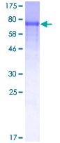 SDS-PAGE - Recombinant Human STAM2 protein (GST tag N-Terminus) (AB132279)