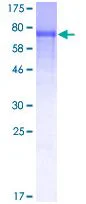 SDS-PAGE - Recombinant Human STAM2 protein (GST tag N-Terminus) (AB132279)