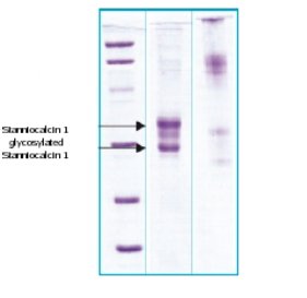 SDS-PAGE - Recombinant Human Stanniocalcin 1/STC protein (AB63280), expandable thumbnail