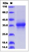 SDS-PAGE - Recombinant Human Stanniocalcin 1/STC protein (His tag) (AB276654), expandable thumbnail