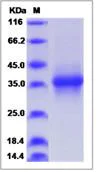 SDS-PAGE - Recombinant Human Stanniocalcin 1/STC protein (His tag) (AB276654)