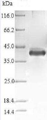 SDS-PAGE - Recombinant Human Stanniocalcin 1/STC protein (Tagged) (AB238347), expandable thumbnail