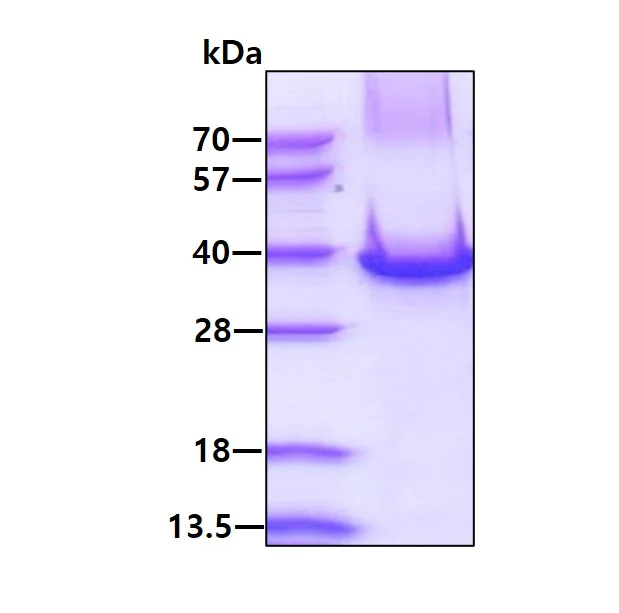 SDS-PAGE - Recombinant Human Stanniocalcin 2/STC-2 protein (His tag N-Terminus) (AB156715)