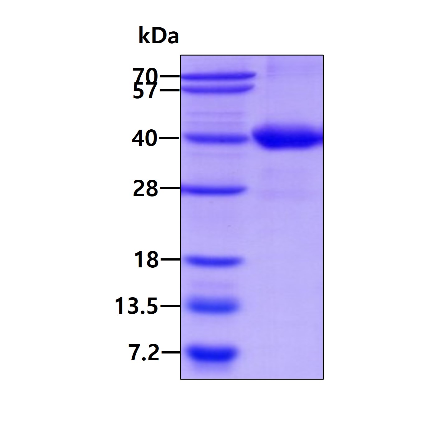 SDS-PAGE - Recombinant Human STAP-1 protein (AB126657)