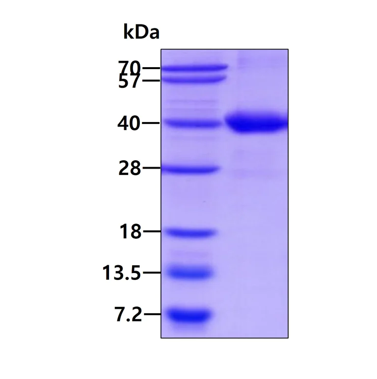 SDS-PAGE - Recombinant Human STAP-1 protein (His tag N-Terminus) (AB126657)