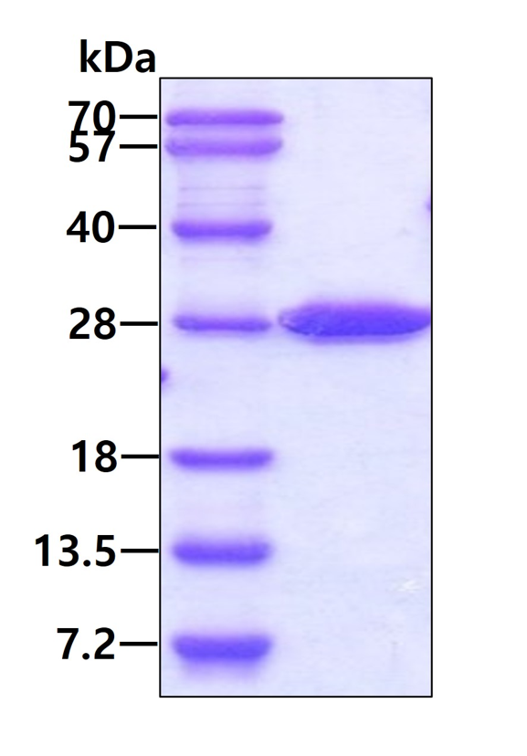 SDS-PAGE - Recombinant Human STARD5 protein (AB176085)