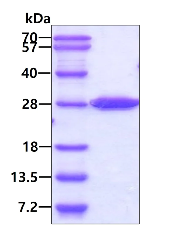 SDS-PAGE - Recombinant Human STARD5 protein (His tag N-Terminus) (AB176085)