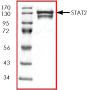 Western blot - Recombinant Human STAT2 protein (GST tag N-Terminus) (AB43617)