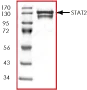 Western blot - Recombinant Human STAT2 protein (GST tag N-Terminus) (AB43617)