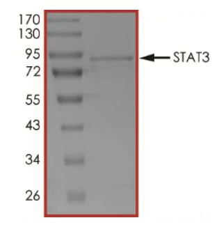 SDS-PAGE - Recombinant Human STAT3 protein (His tag N-Terminus) (AB268982)