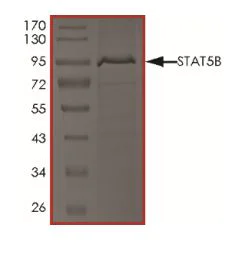 SDS-PAGE - Recombinant Human STAT5b protein (His tag) (AB268983)