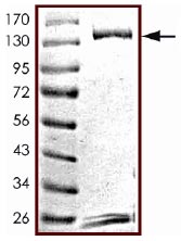 SDS-PAGE - Recombinant Human STAT6 protein (AB125625)
