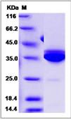 SDS-PAGE - Recombinant Human Statherin protein (Fc Chimera) (AB276578)