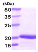 SDS-PAGE - Recombinant Human Stathmin 1 protein (AB87492)