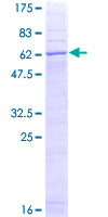 SDS-PAGE - Recombinant Human STEAP1 protein (GST tag N-Terminus) (AB162041)
