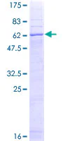 SDS-PAGE - Recombinant Human STEAP1 protein (GST tag N-Terminus) (AB162041)