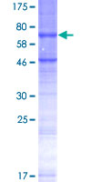 Recombinant Human STEAP2 protein