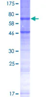 SDS-PAGE - Recombinant Human STEAP2 protein (GST tag N-Terminus) (AB166097)