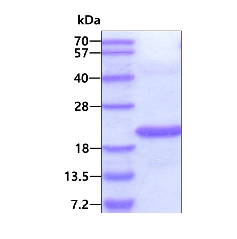 SDS-PAGE - Recombinant Human STEAP4 protein (denatured) (His-DDDDK tag N-Terminus) (AB177658)