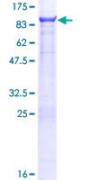 SDS-PAGE - Recombinant Human STEP / PTPN5 protein (AB132095), expandable thumbnail