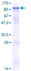 SDS-PAGE - Recombinant Human Steroid sulfatase protein (GST tag N-Terminus) (AB152197)