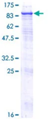 SDS-PAGE - Recombinant Human Steroid sulfatase protein (GST tag N-Terminus) (AB152197)