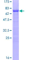 SDS-PAGE - Recombinant Human Steroidogenic Factor 1/SF-1 protein (AB114599)