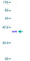 SDS-PAGE - Recombinant Human Sterol carrier protein 2 (GST tag N-Terminus) (AB117049)