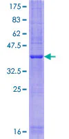 SDS-PAGE - Recombinant Human STF2D1 protein (GST tag N-Terminus) (AB165001)
