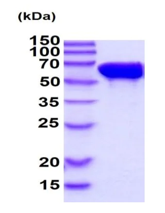 SDS-PAGE - Recombinant Human STIP1/STI1 protein (AB222344)